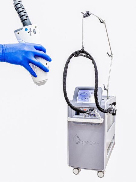 DIODE laser (housing candela)